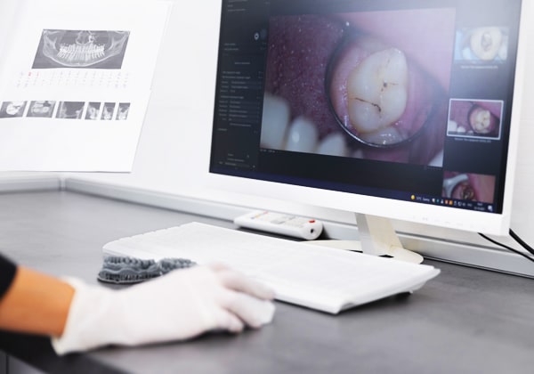 Dental Diagnostics